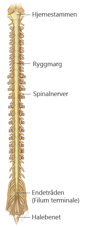 illustrasjon kreft i sentralnervesystemet, intraspinal. Kreftlex.no