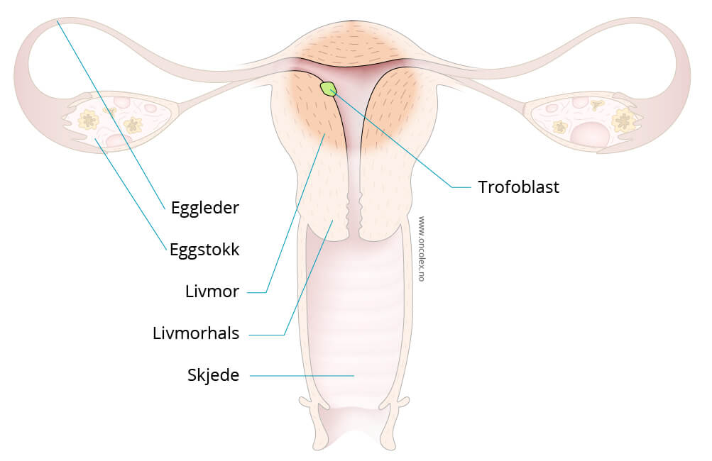 Illustrasjon kreftlex.no. Livmor, livmorhals, skjede, eggstokker, eggledere, trofoblast. @Jostein Eikanger