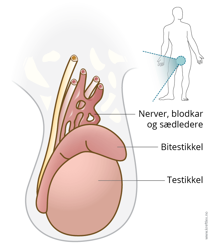 illustrasjon @kreftlex.no, scrotum, testikkelkreft, testikler