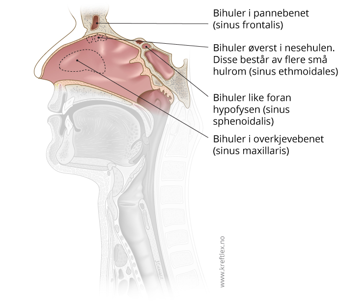 illustrasjon Kreftlex, Kreft i nese og bihuler. Jostein Eikanger