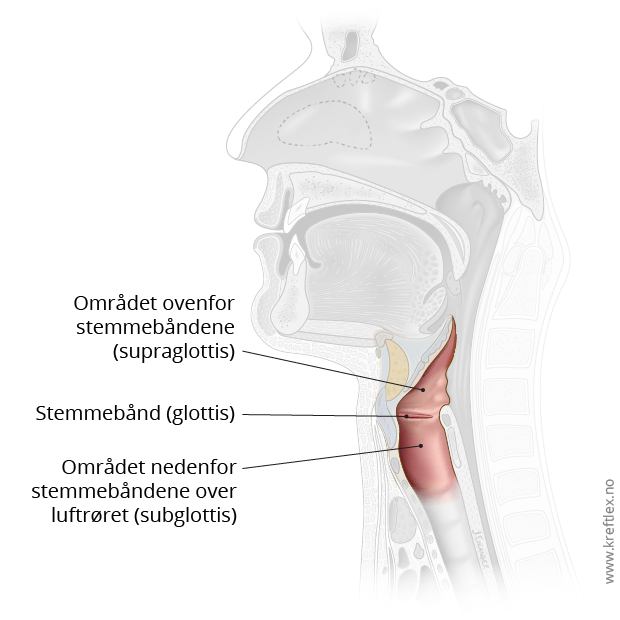 illustrasjon Kreftlex, Kreft i strupehode. Viser strupehode, med stemmebåndene og områdene ovenfor og nedenfor. Tegnet av Jostein Eikanger