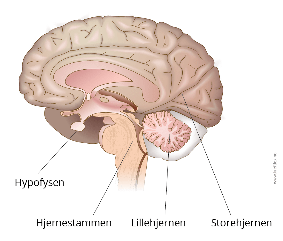 illustrasjon @kreftlex, intrakranial, hjernekreft, lillehjernen, storehjernen, hjernestamme, hypofyse