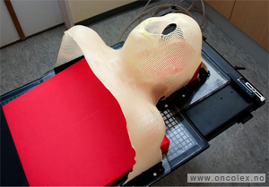 bilde fra strålebehandling, maske for stråling av hode- og halsregion