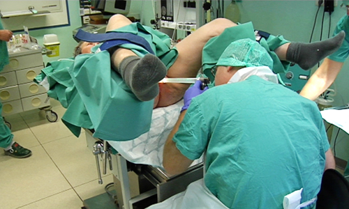 Rektoskopi, slik utføres undersøkelse av endetarmen