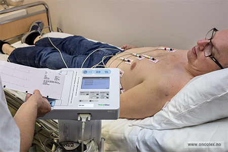 EKG-apparatet måler elektrisk aktivitet i hjertet ved hjelp av elektroder festet til pasientens kropp.