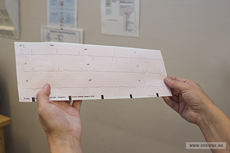 Elektrokardiogrammet etter hjerteundersøkelse (EKG)